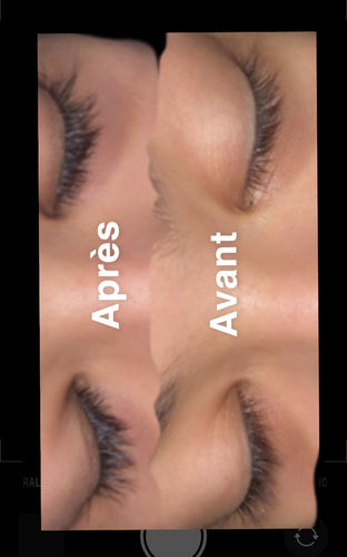 Cils plus longs et épais – Avant et après application du sérum pousse des cils Lashbydiyana
