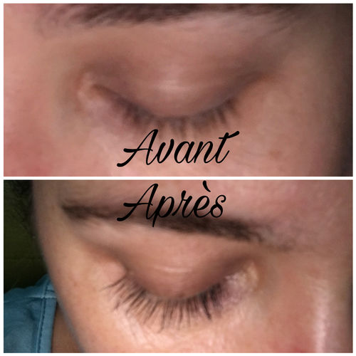 Transformation des cils avec le serum pousse des cils  LashbyDiyana – Avant-apres